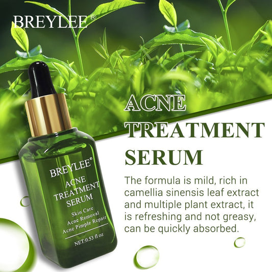 BREYLEE Acne Treatment Serum Face Facial Anti Acne Scar Removal Cream Skin Care Whitening Repair Pimple Remover For Acne amna
